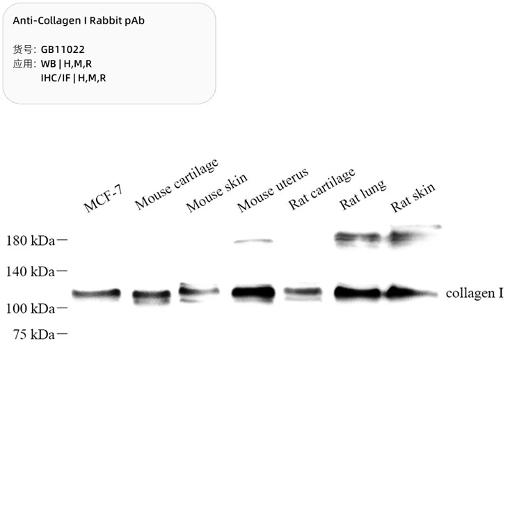 Anti Collagen I Rabbit PAB